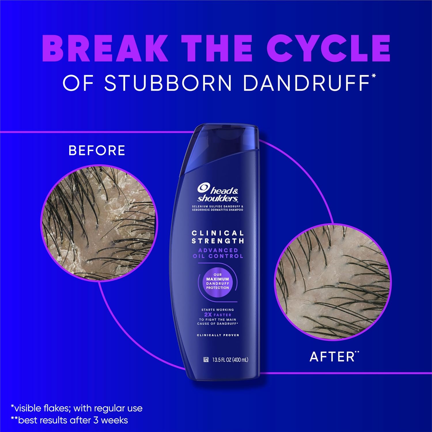 Head & Shoulders Anti-Dandruff Shampoo with 1% Selenium Sulfide, Clinical Strength Advanced Oil Control Twin Pack, Seborrheic Dermatitis Relief, Oily Scalp, 13.5 fl oz Each